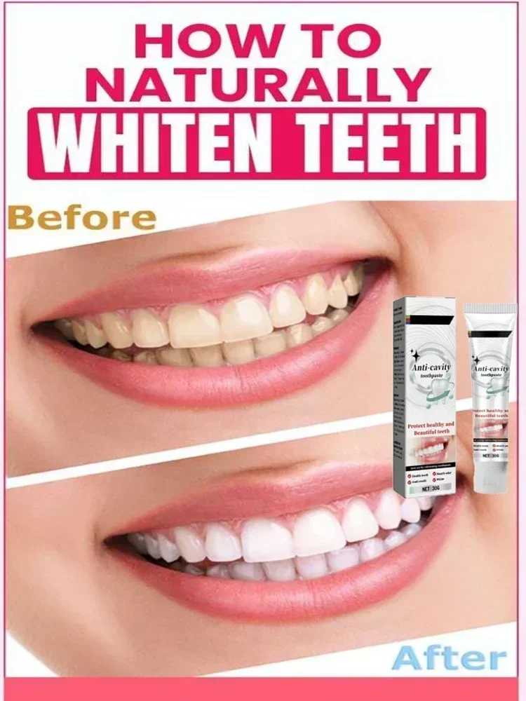 

2024New Upgrade Quick Repair of Cavities Caries Removal of Plaque Stains Decay Whitening Yellowing Repair Teeth Teeth Whitening0