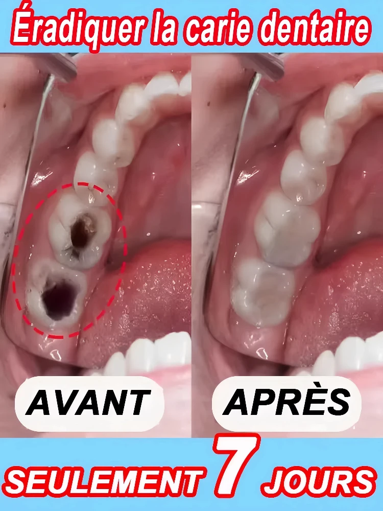 

Hot selling tooth drops, repair damaged gums, relieve gum pain, strengthen gums, restore healthy gums yyds
