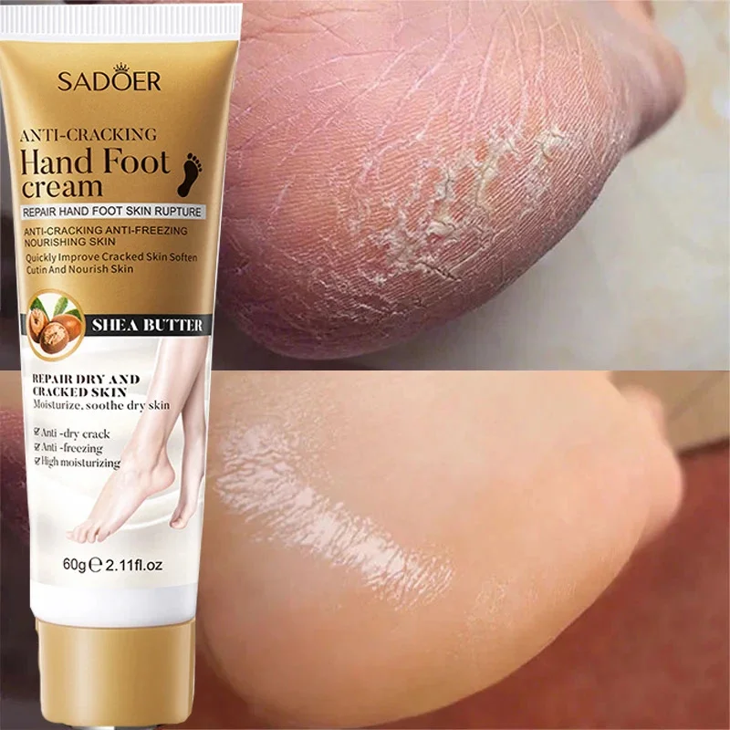 Anti Crack Hand Foot Cream Salto Anti-Secagem Reparação Rachada Máscara de Pés Removedor de Clareamento Hidratante Pele Morta, Produtos para Cuidados com os Pés