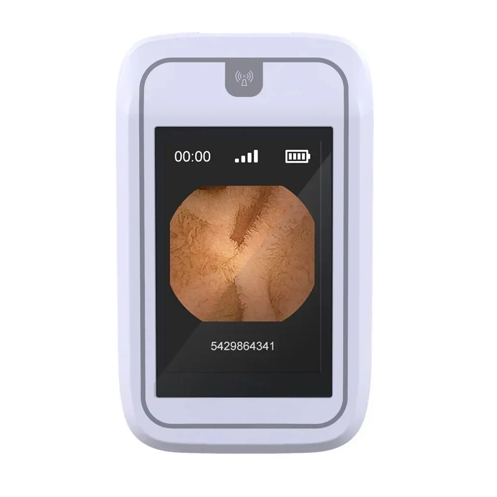 

capsul endoscope medical gastrointestinal examination high-definition endoscope