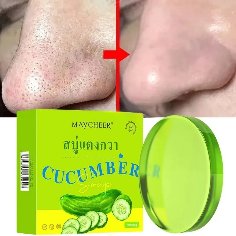 

Pore Cleaning Soap Anti-Acne Shrink Pores Deep Remove Blackheads Chicken Skin Oil Control Moisturizer whitening Smooth Skin Care