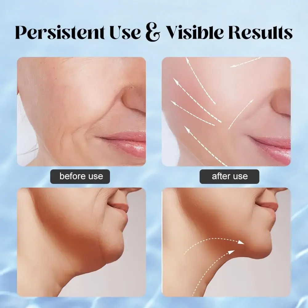 Neck Facial Lifting Device Skin Tightening Anti Wrinkle EMS Microcurrent Face Massager Double Chin Remover Skin Care Beauty Tool