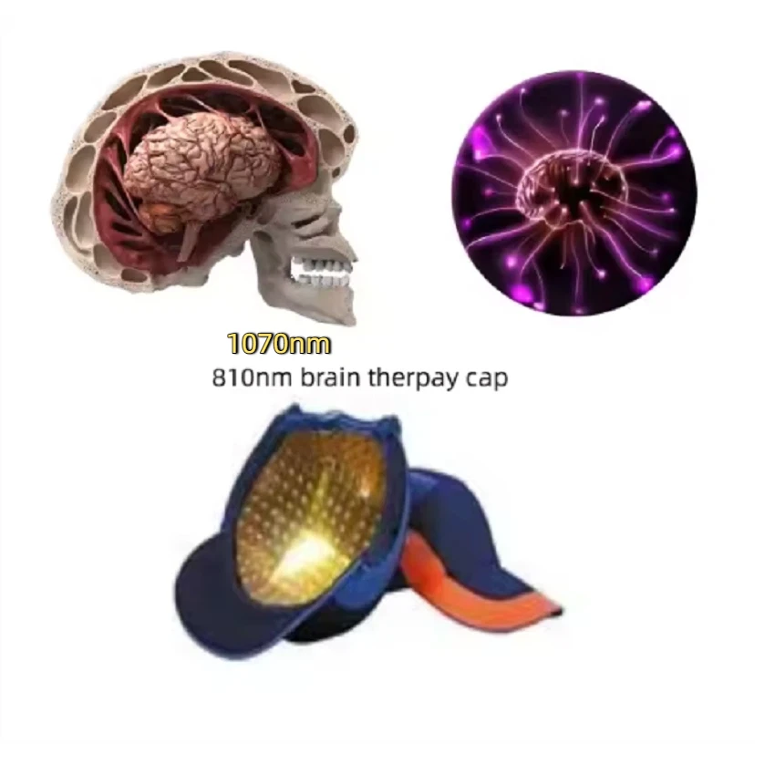 

Transcrainal Neuron 810nm Near Infrared Led Light Photobiomodulation Brain Machine for Dementia Brain disease therapy