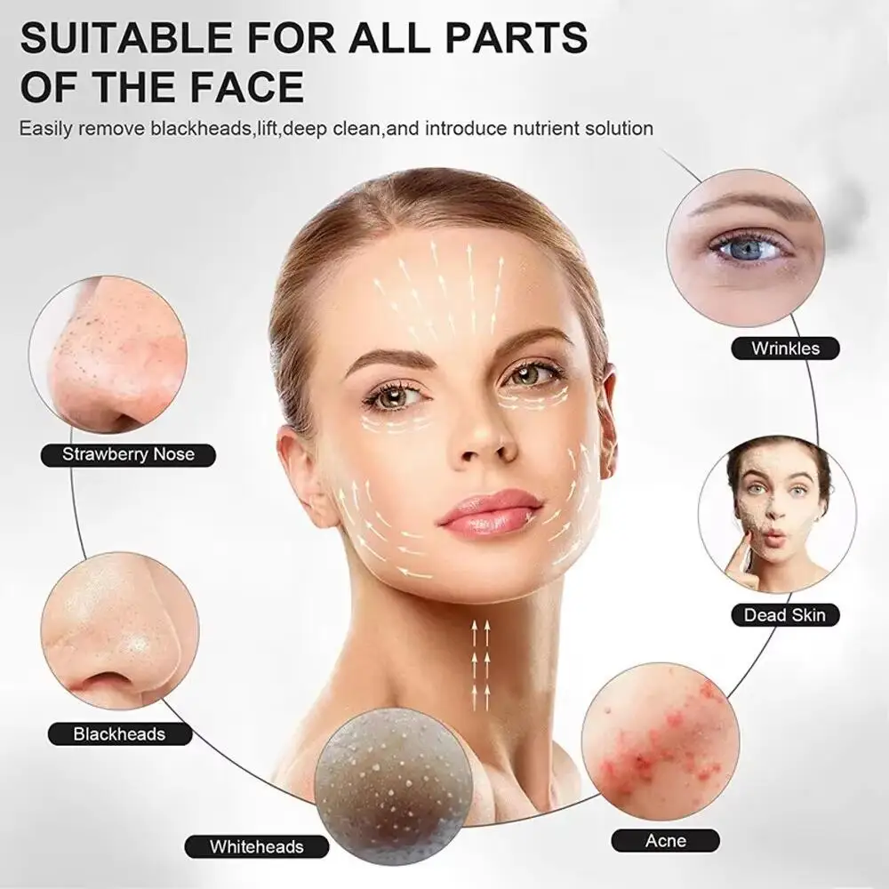 Scrubber ad ultrasuoni per la pelle Scrubber Massaggiatore per il viso Vibrazione profonda Detergente per il viso Pala Scrubber per il viso Peeling Rimozione della testa nera