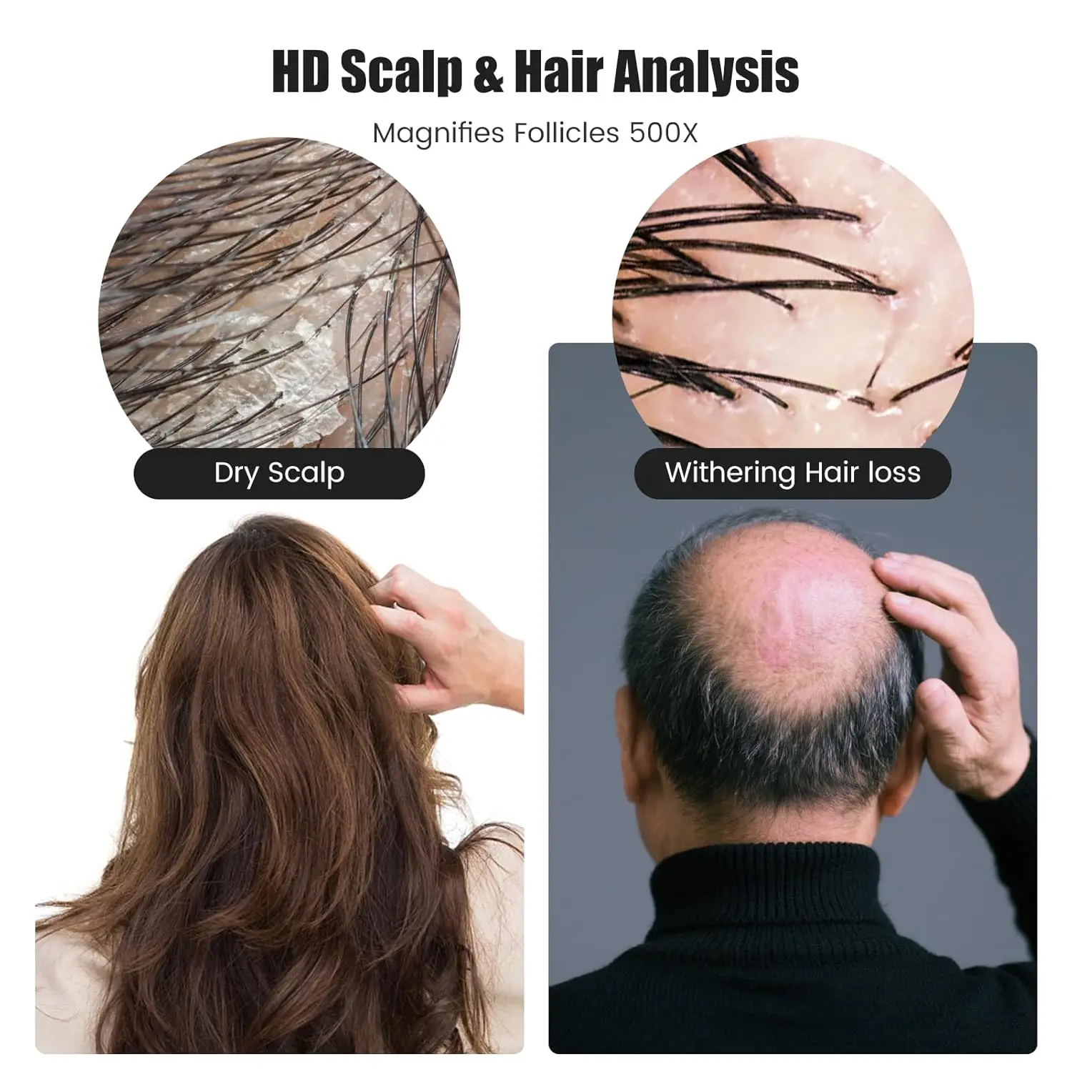 منظار الجلد المحمول مجهر رقمي مع شاشة 1080P IPS، مكبر 500X لفروة الرأس/الشعر تريكومز الوجه