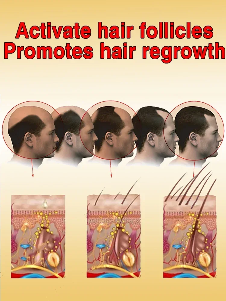 Hair Growth Oil for Men Biotin Fast Treatment Baldness Serum Hair Growth Oil for Black Women Hair Care Treatment beard growth