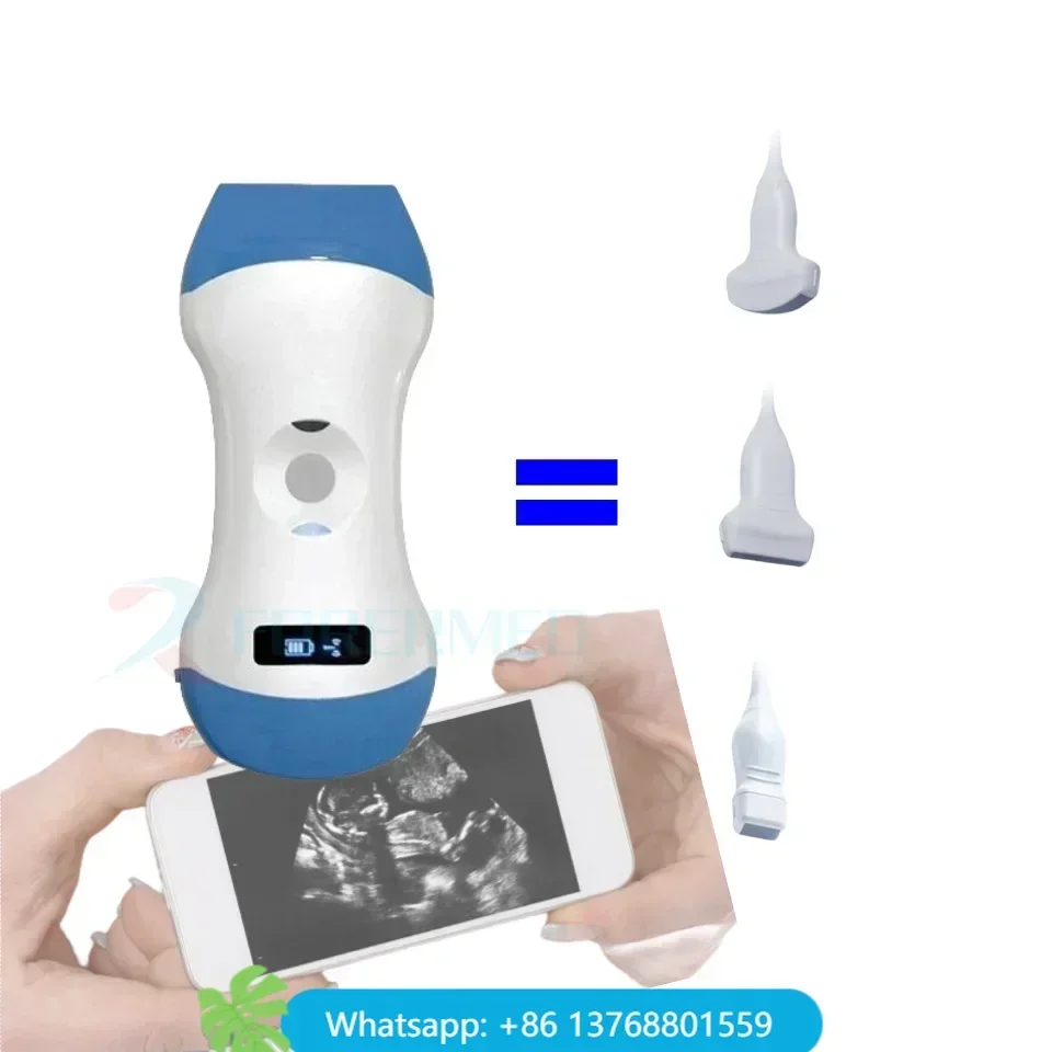 Convex/Phased Array/Linear All-in-one Portable Scanner Wireless Ultrasound Probe Handheld Wifi Ultrasound