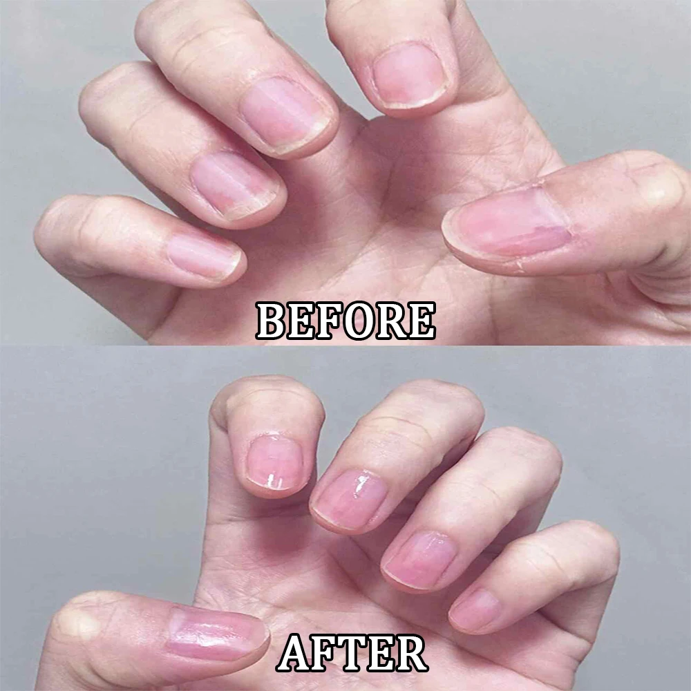 3-in-1 กลิ่นดอกไม้เล็บ Essence Cuticle ปากกาเซรามิค Cuticle Pusher Dead Skin Remover เล็บโภชนาการน้ํามันสําหรับเล็บเครื่องมือดูแล