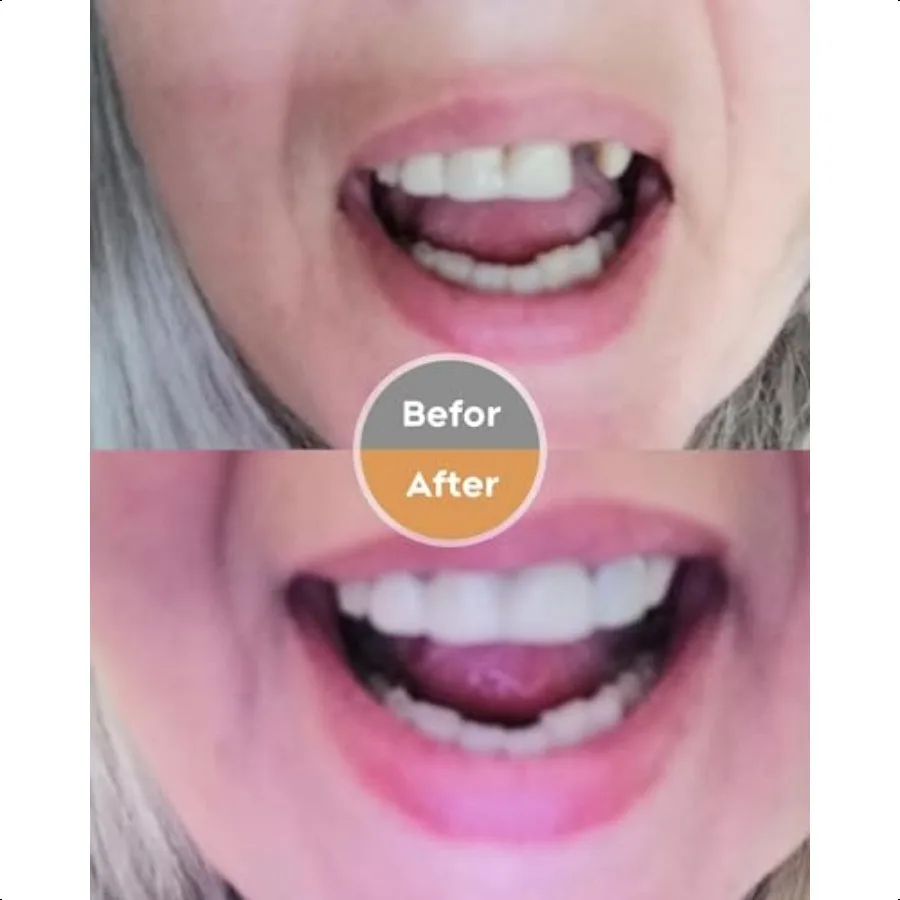 طقم أسنان افعل ذلك بنفسك مجموعة كاملة من الأسنان المزيفة العلوية والسفلية لمجموعة أدوات إصلاح الأسنان المزيفة سهلة ومريحة