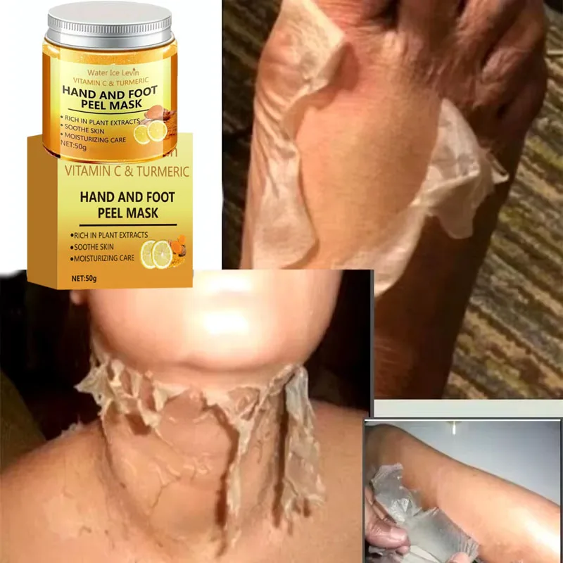 Strong Yellow Peeling Mask Bleach Dark Skin Whiten Lotion Lighten Body Elbow Knee Hand Exfoliate Dead Skin Nourish Even SkinTone