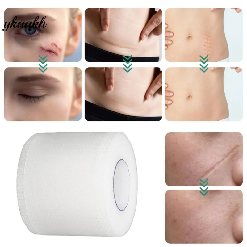 

Silicone Scar Patch Transparent Scar Tape Roll Scar Sheet Removal Self-Adhesive Tape Therapy Patch Burn Acne Surgical Scar Skinc