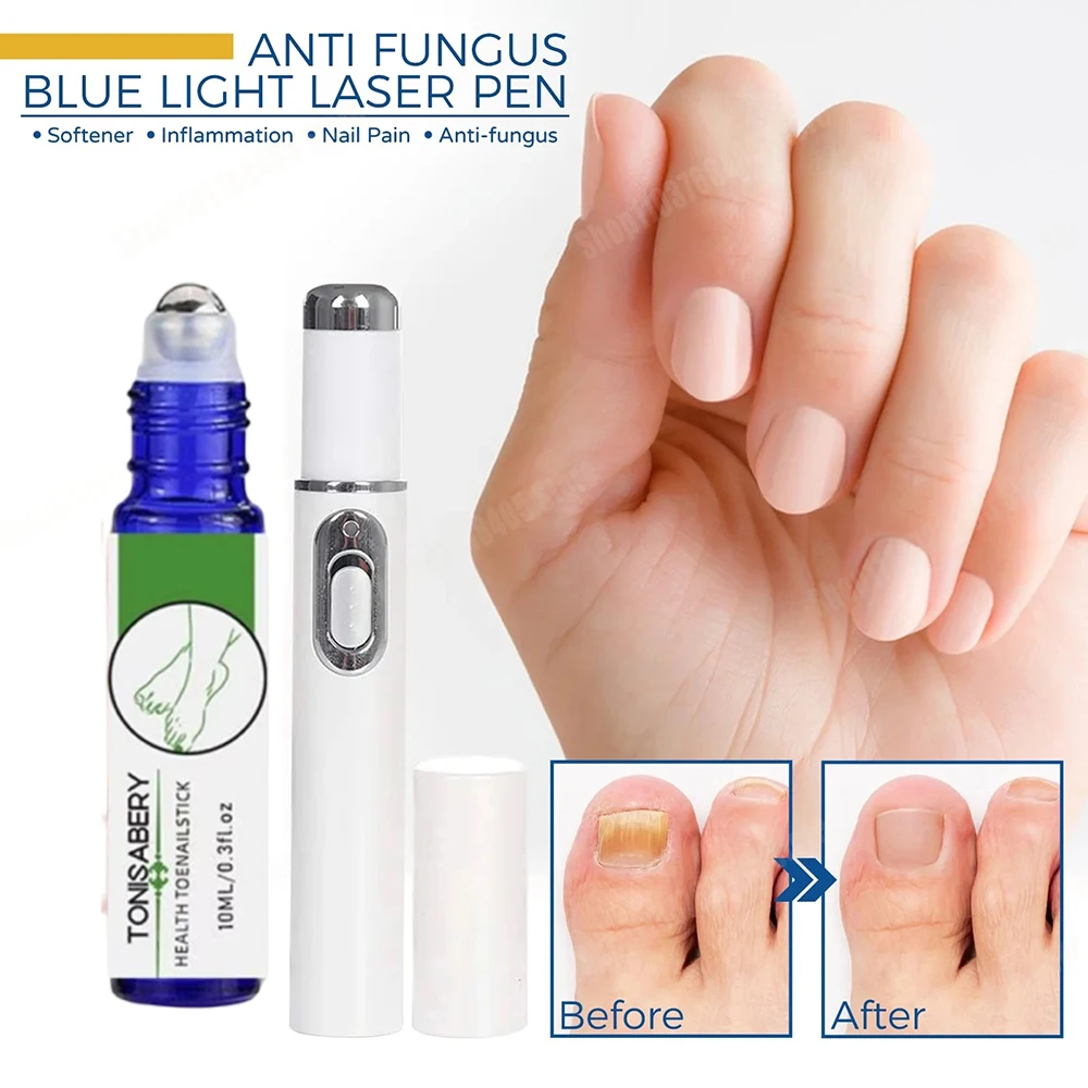 爪真菌レーザーペン 爪真菌クリーニングレーザー装置 爪真菌レーザー治療 損傷した変色した厚い足の爪