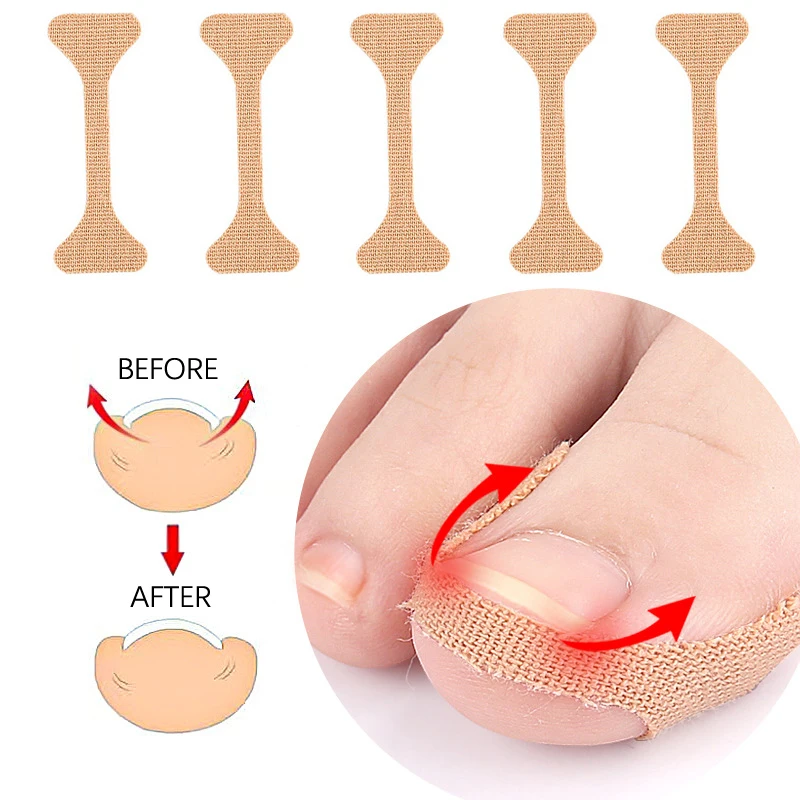 5/15/30 Pcs Ingrown Paronychia Toenail Corrector Strips Anti Fungal Nail Correction Stickers Anti Infection Nail Treatment Patch