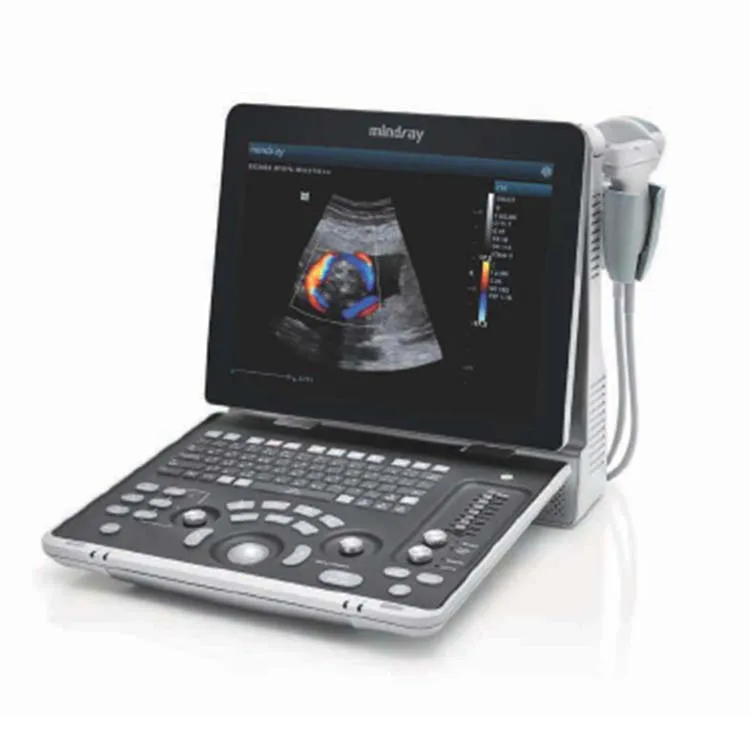 CE Best Price Clinic Hospital laptop mindray ultrasound B/W display ultrasound machine price