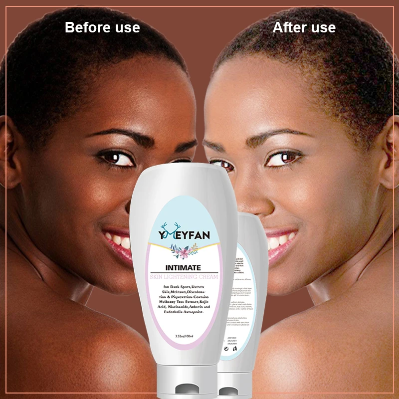 100g Natural Skin Whitening Cream For Dark Skin Bleaching Africa Snow White Lightening for Sensitive Area Leg Elbows Underarm