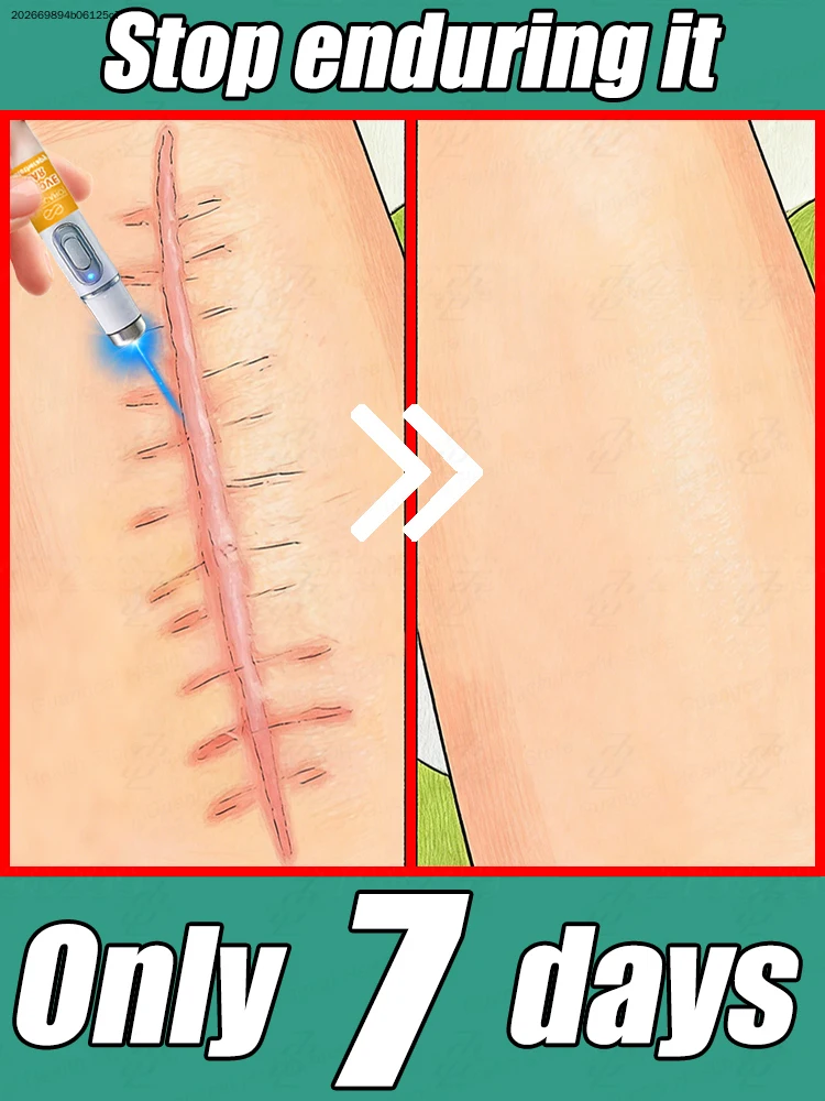 

Горячая распродажа 2026: Удаление всех видов шрамов. Попрощайтесь с неповерхденной уверенностью в себе.