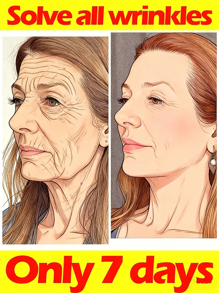 

Бесплатная доставка Лазерная ручка решает морщины