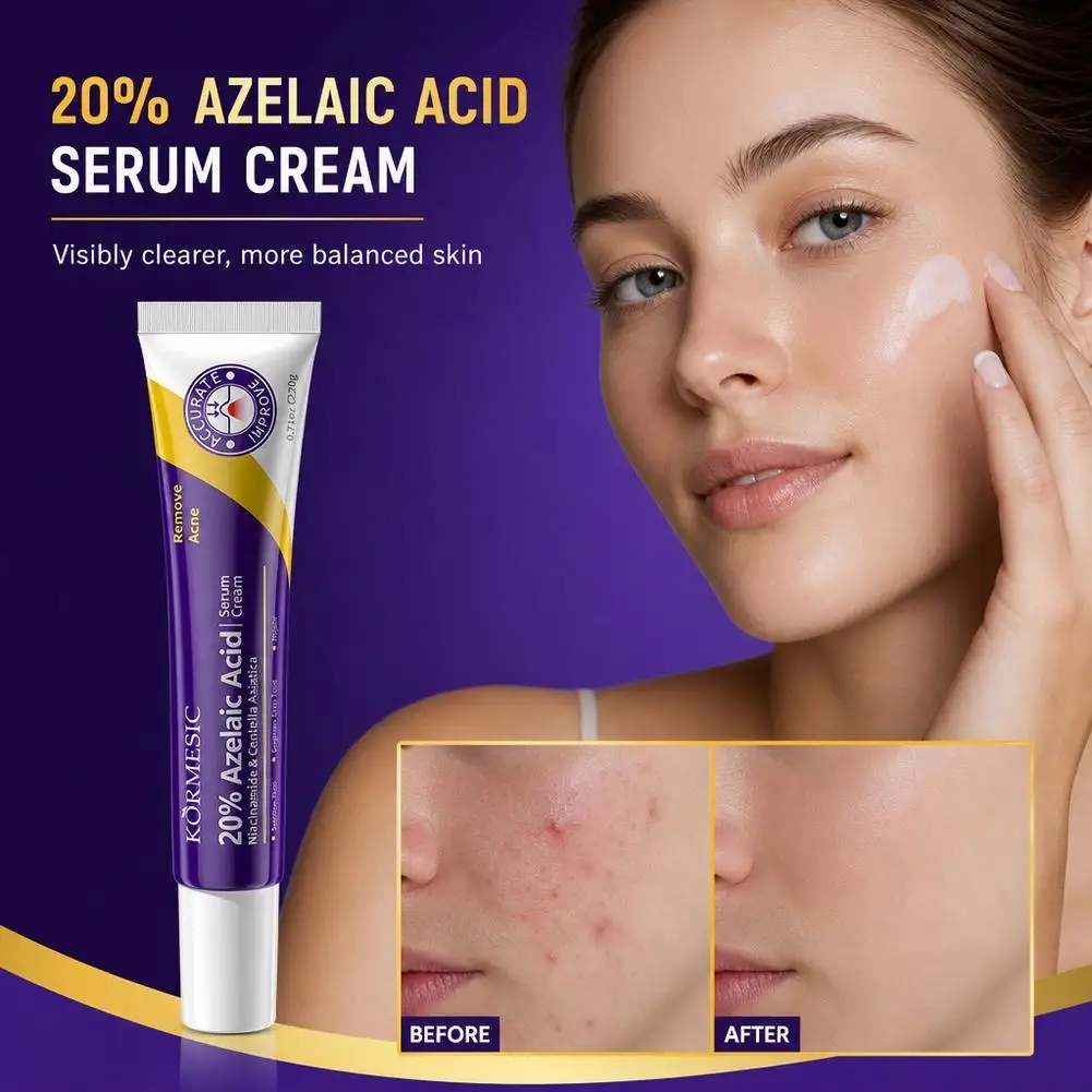 Niacinamide Blemish Control Cream Centella Asiatica Dark Spot Corrector Acne Spot Treatment Serum Cream Brightening Soothing