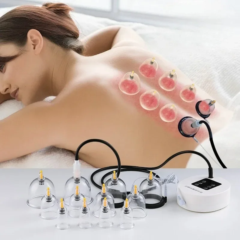 Electric Vacuum Cupping Massager with 6/12 Cups Suction Heating Function for Body Slimming Anti Cellulite Muscle Pain Relief