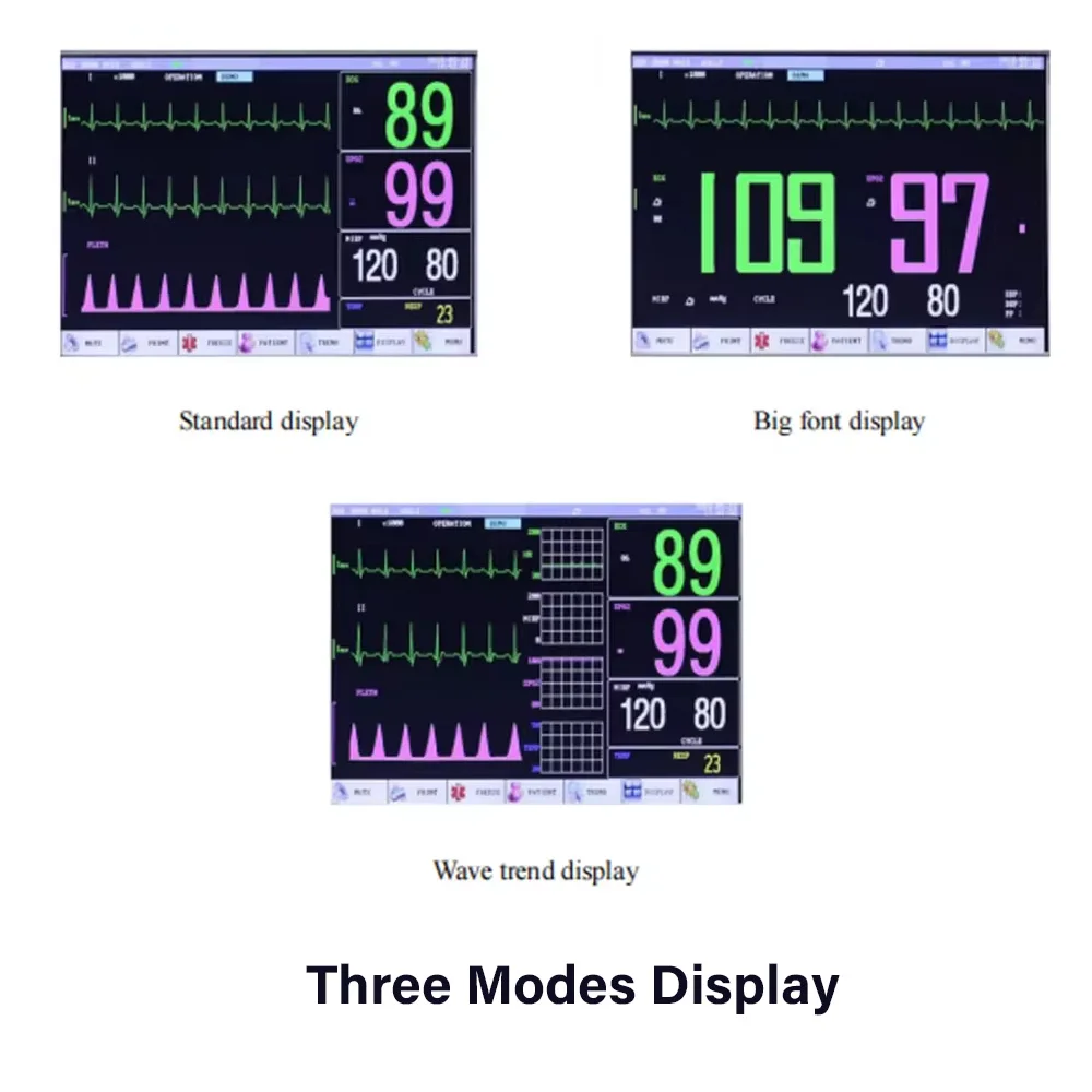 7 Inch Portable Pet Veterinary Monitor ECG/NIBP/PR/SPO2/RESP/TEMP Veterinary Medical Clinic Multiparameter Animals Monitor