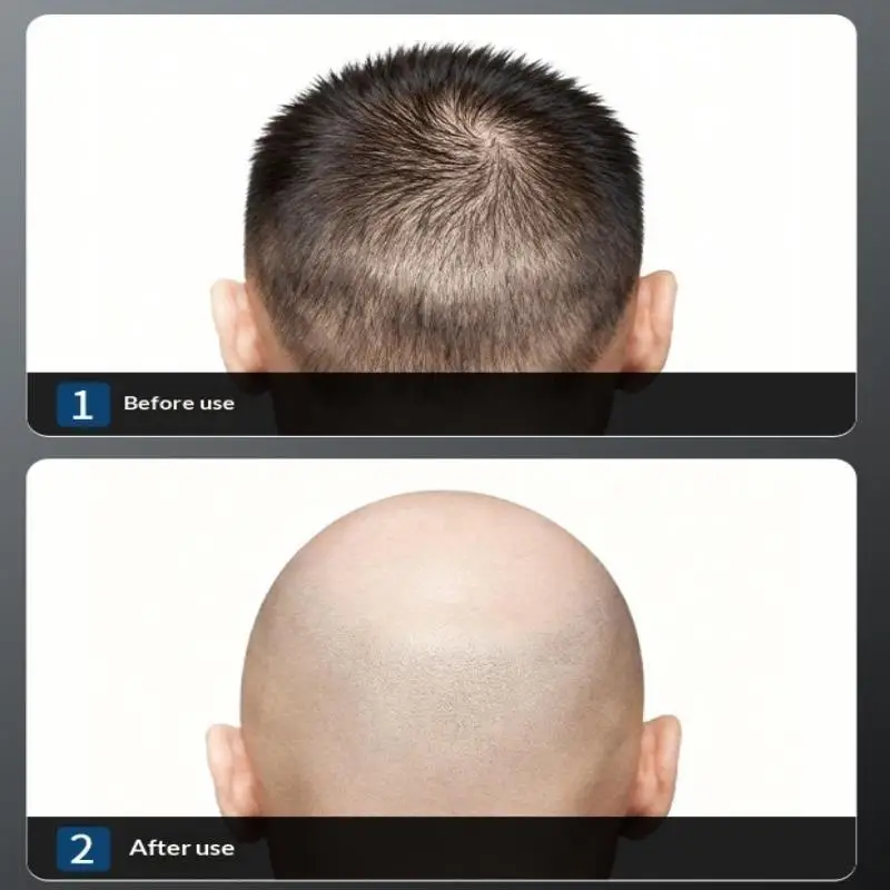 New Manual Bald Head Special Razor Smooth Stubble Free Precision Trimming Hair Removal Grooming Essential