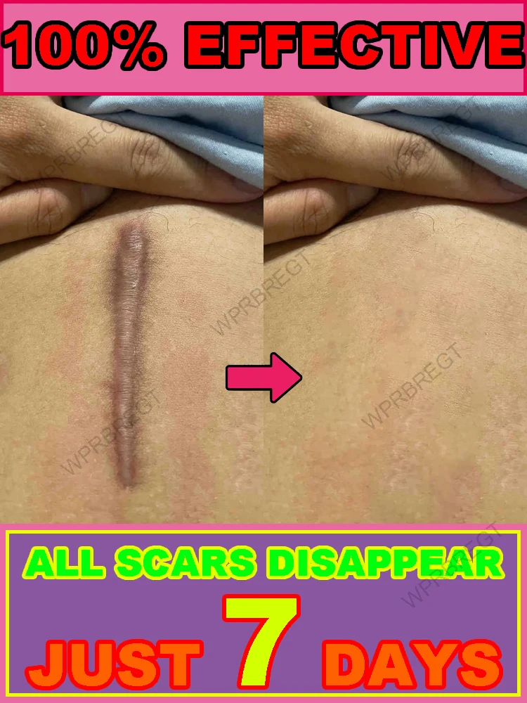 

Want naturally flawless skin Try this!