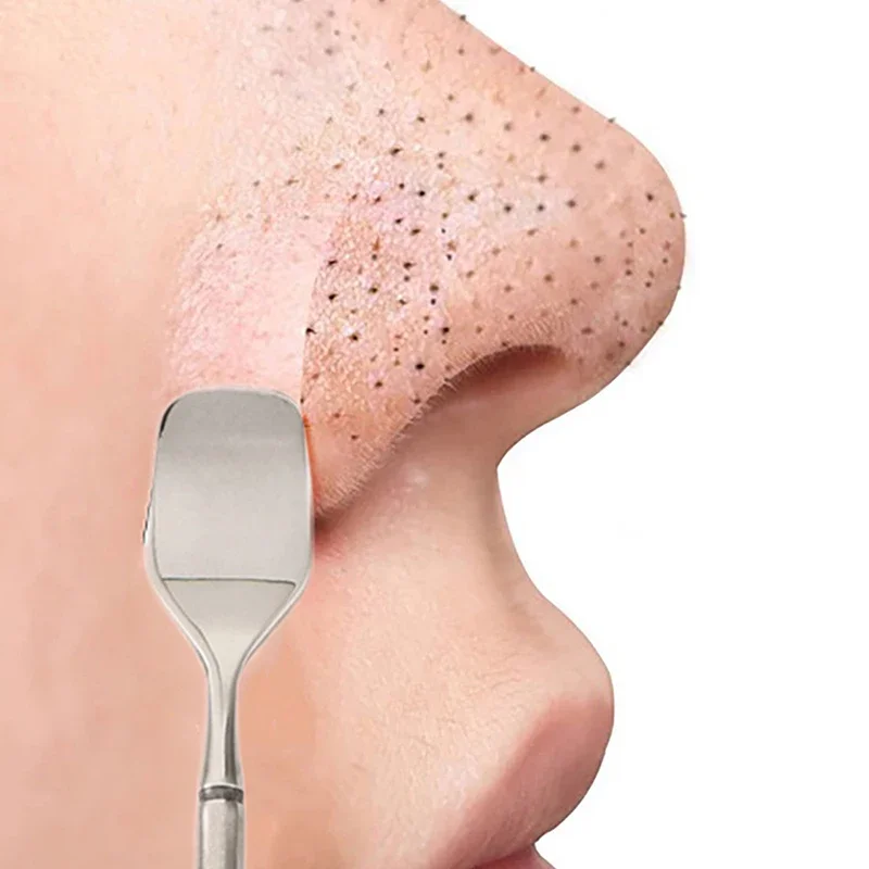 Grattoir de nettoyage de points noirs à Double tête en acier inoxydable, dissolvant de points noirs, outil d'extraction de imperfections, élimination des boutons du visage et des comédons