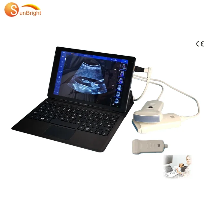 SUN-901B Portable Medical Color Doppler Probe Pocket USB Ultrasound Machine Ultrasound Scanner