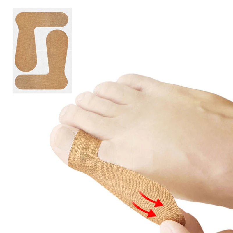 2/10/20 buah koreksi jempol Patch besar korektor jari kaki pengatur Finger Toe Patch pelindung Hallux Valgus ortopedi stiker