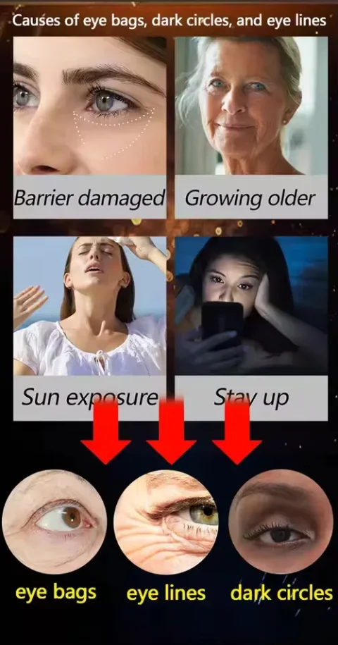 كريم عين لمكافحة الشيخوخة أكياس الهالات السوداء الانتفاخ رائع تحت العين الجلد شد الوجه كريمات العناية لشد العين #6