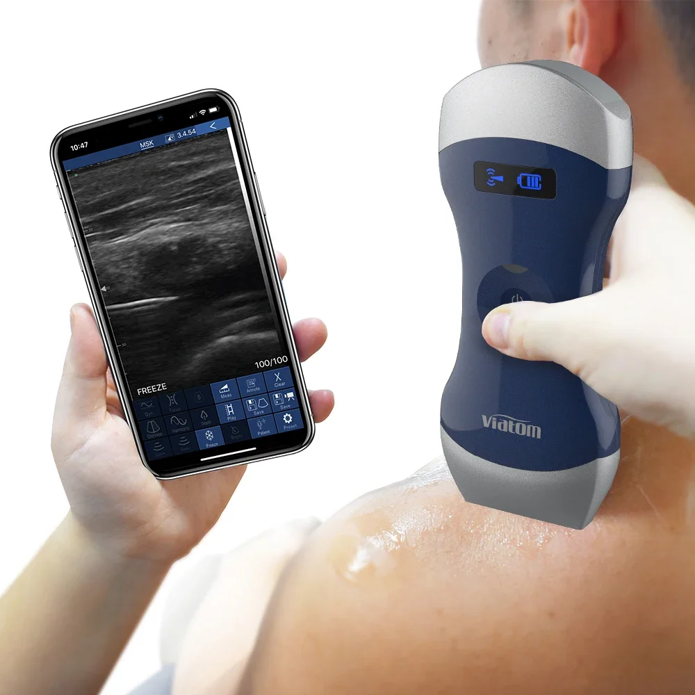 Viatom Dual Head-6 Wireless Dual Scan Probe Diagnostic Ultrasound Machine Wireless