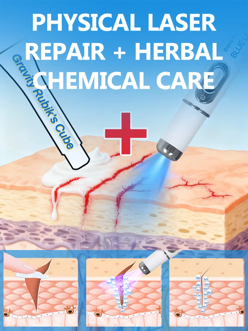 Strumenti per la cura della pelle dopo il parto Prodotti per smagliature corporee