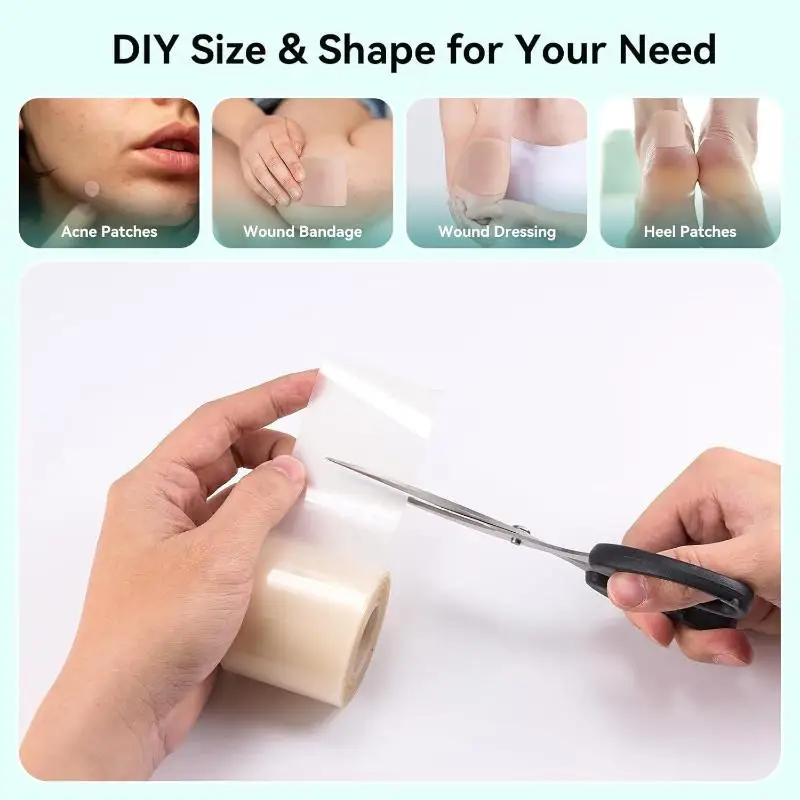 1 rotolo di cerotto idrocolloidale per una cura efficace delle ferite Nastro di copertura cicatrice autoadesivo impermeabile morbido extra sottile