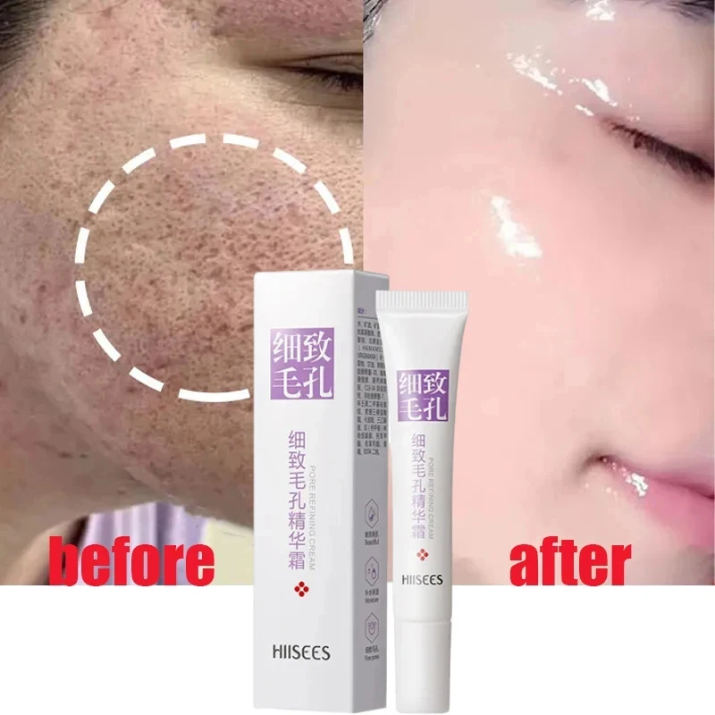 Crema retráctil de poros con ácido salicílico, suero Facial para eliminar cicatrices de acné, estiramiento de cara, piel suave, cuidado de la piel coreana