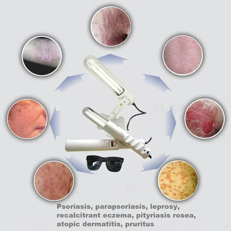 Lámpara de rayos ultravioleta de fototerapia UVB 311nm para el hogar para aliviar la psoriasis y el eczema 110V/220V - Dispositivo de soporte para el cuidado de la piel