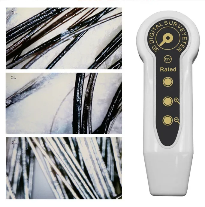 Portable 50X 200X Magnifier Skin Analyzer Hair Scalp Detector Hair Follicles Tester Tool