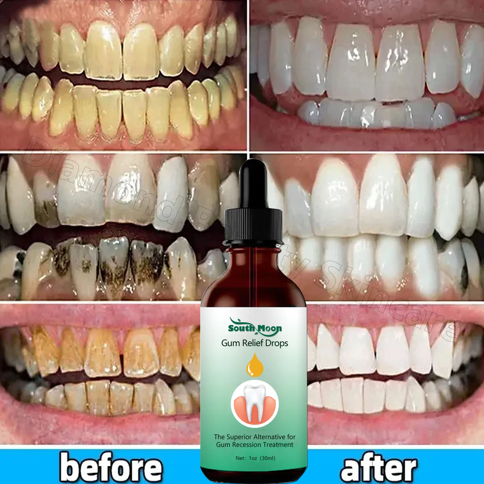 Rapid Repair Gums Serum Effectively Relieve Tooth Allergy Dental Caries Relieve Tooth Damage Drops Tooth Cleaning Toothpaste