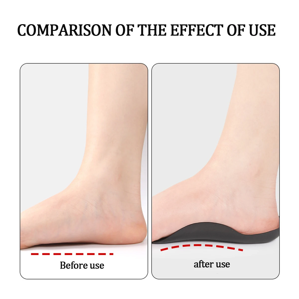 Plantar Fasciitis Relief Arch Support Inserts Flat Feet Orthotics Women Men for Foot Pain Relief, X/O Legs Correction Foot Care