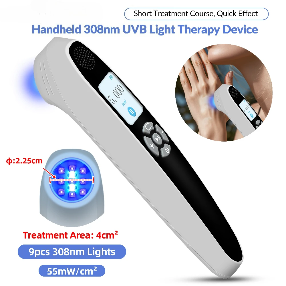Laser Excimer 308 Nm Eczema and Psoriasis Vitiligo Covering UV Phototherapy Light Therapy Lamp for Allergies Home Use Handheld