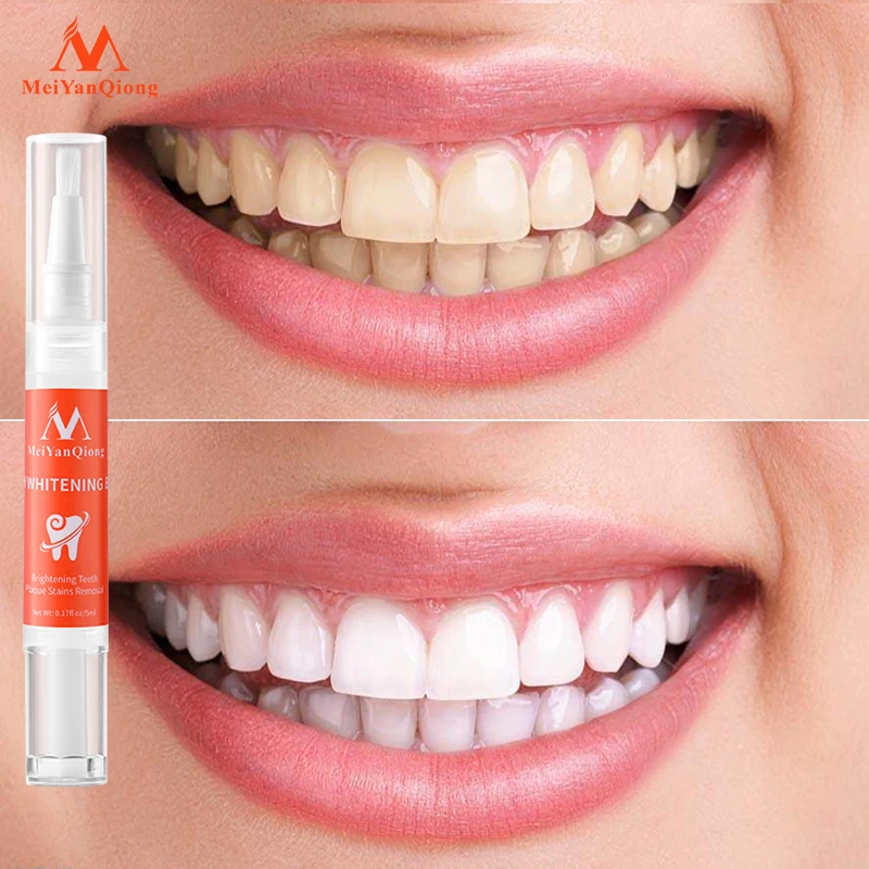 

MeiYanQiong Teeth whitening pen Effectively Removes Tartars Teeth Cleaning Oral Hygiene Dental Tools Oral Care Whiten teeth