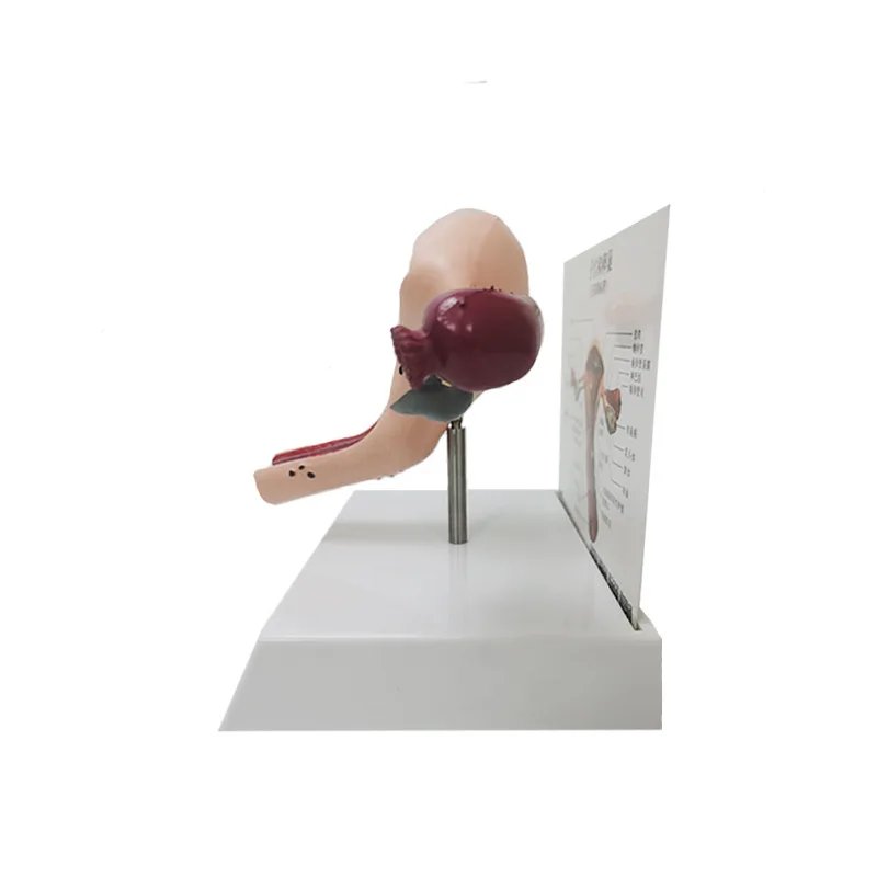 Medical Human Pathological Uterine And Ovarian Anatomical Model Gynecological Display Medical Teaching Supplies