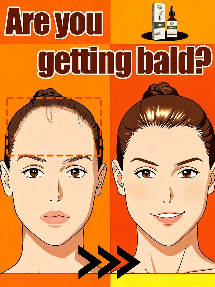 

Bᴀʟᴅɴᴇss ᴡᴏʀʀɪᴇs Hᴀɪʀ ɢʀᴏᴡᴛʜ ᴘʀᴏᴍᴏᴛᴇs ʜᴀɪʀ ɢʀᴏᴡᴛʜ ɪɴ 7 ᴅᴀʏs