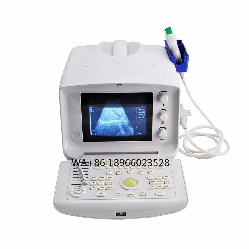 

10 inch LCD Screen Full Digital Ultrasound Scanner USG Machine