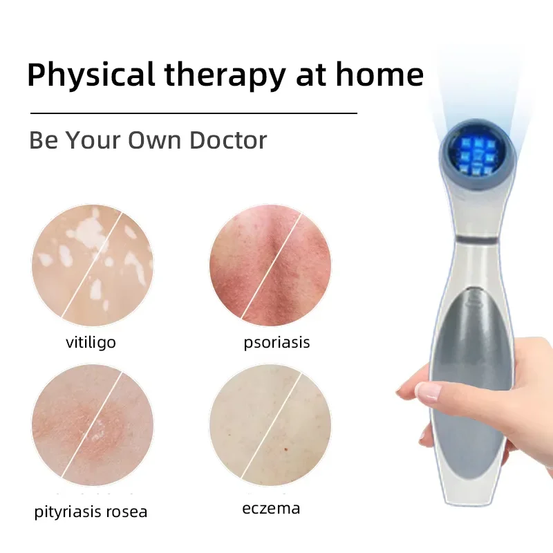 

UV lamp for Vitiligo Psoriasis Treatment UV 311nm Ultraviolet Phototherapy Device UsesLamp UVB To Treat Vitiligo