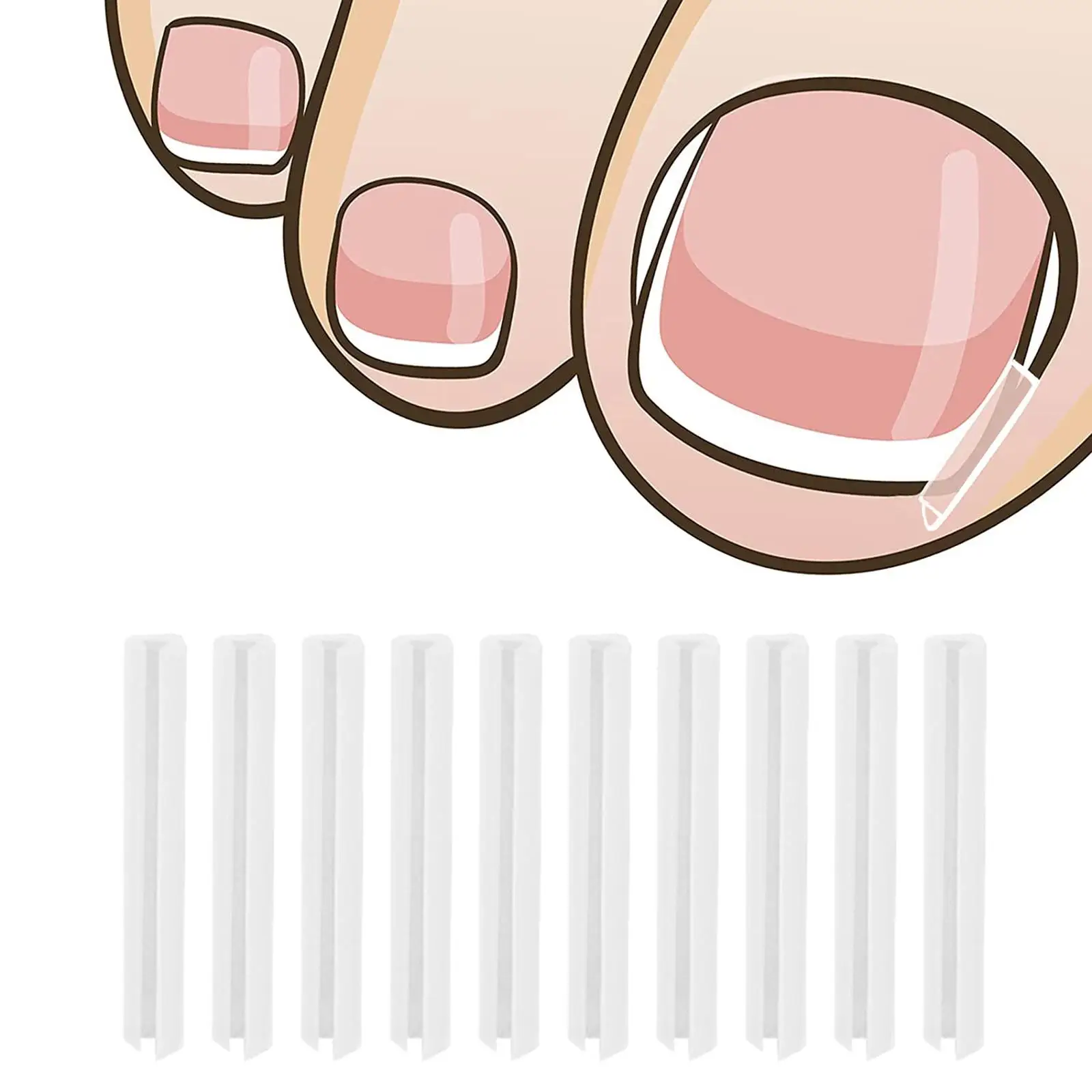 Tiras correctoras de uñas encarnadas para hombres, tratamiento con ranura para uñas, cuidado de los pies, 10 unidades