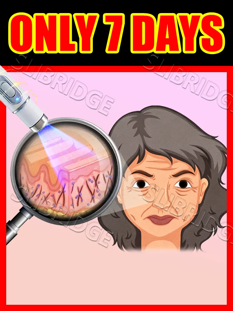 تنعيم علامات الشيخوخة، أدوات العناية بالبشرة، قلم الضوء الأزرق يحل التجاعيد، شحن مجاني