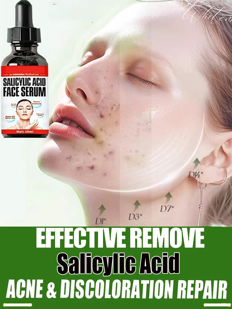 

Salicylic Acid Solution Essence 10mL Shrink pores and Acne Spot Removing Shrink Pores Oil-Control Brighten Face Skin Makeup