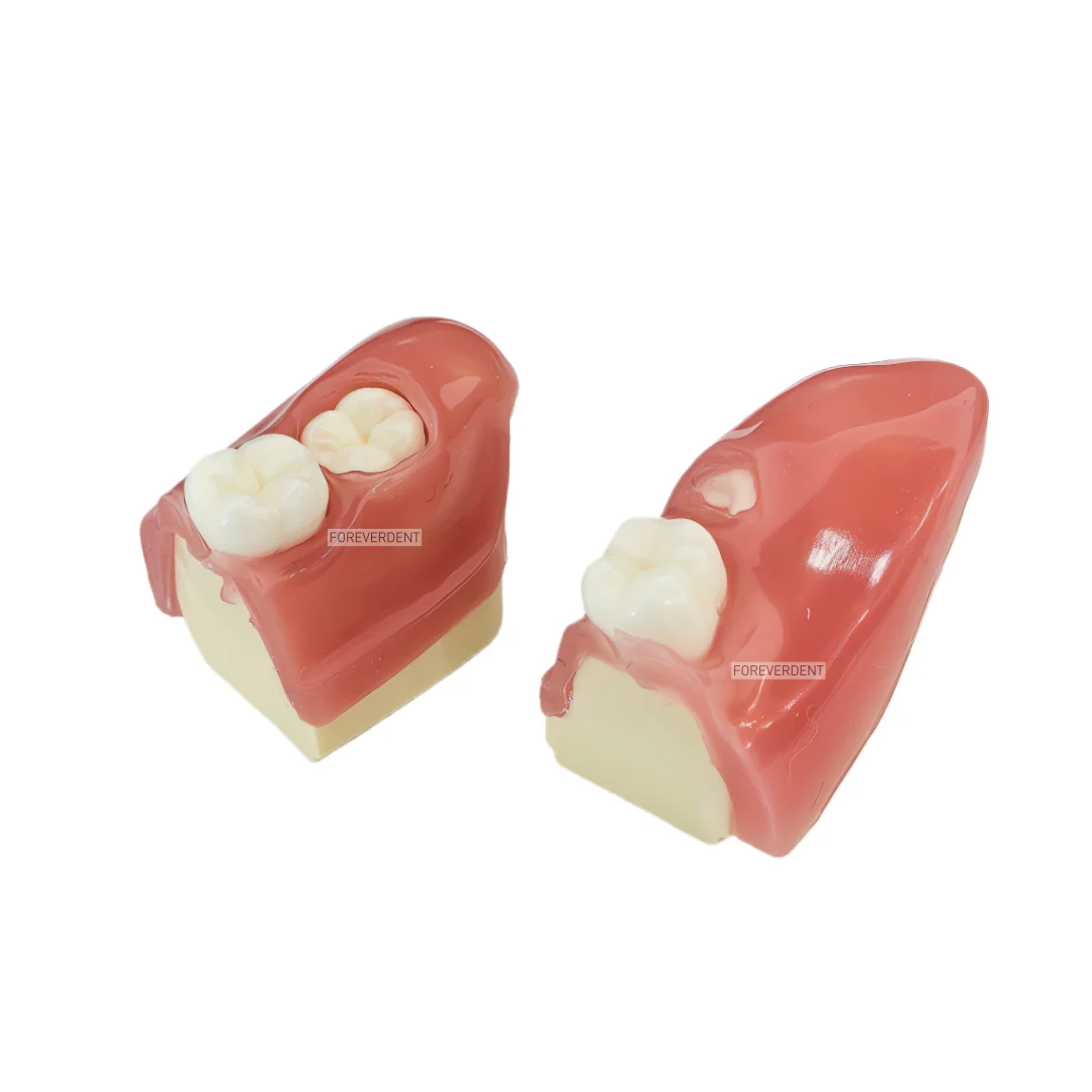 Picture 5: M8026 Impacted Wisdom Tooth Extraction Training Model Dental Tooth Model Oral Teaching Replaceable Base