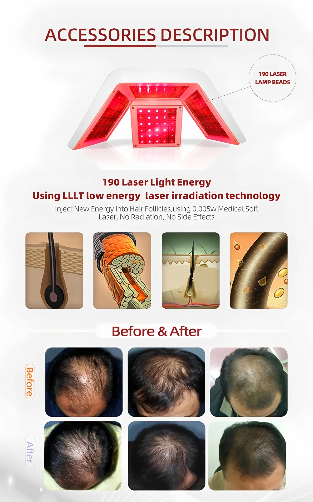 المهنية آلة نمو الشعر سبا فروة الرأس محلل التنظيف العميق الجمال الصحة إزالة الصباغ معدات شد الجلد لصالو #4