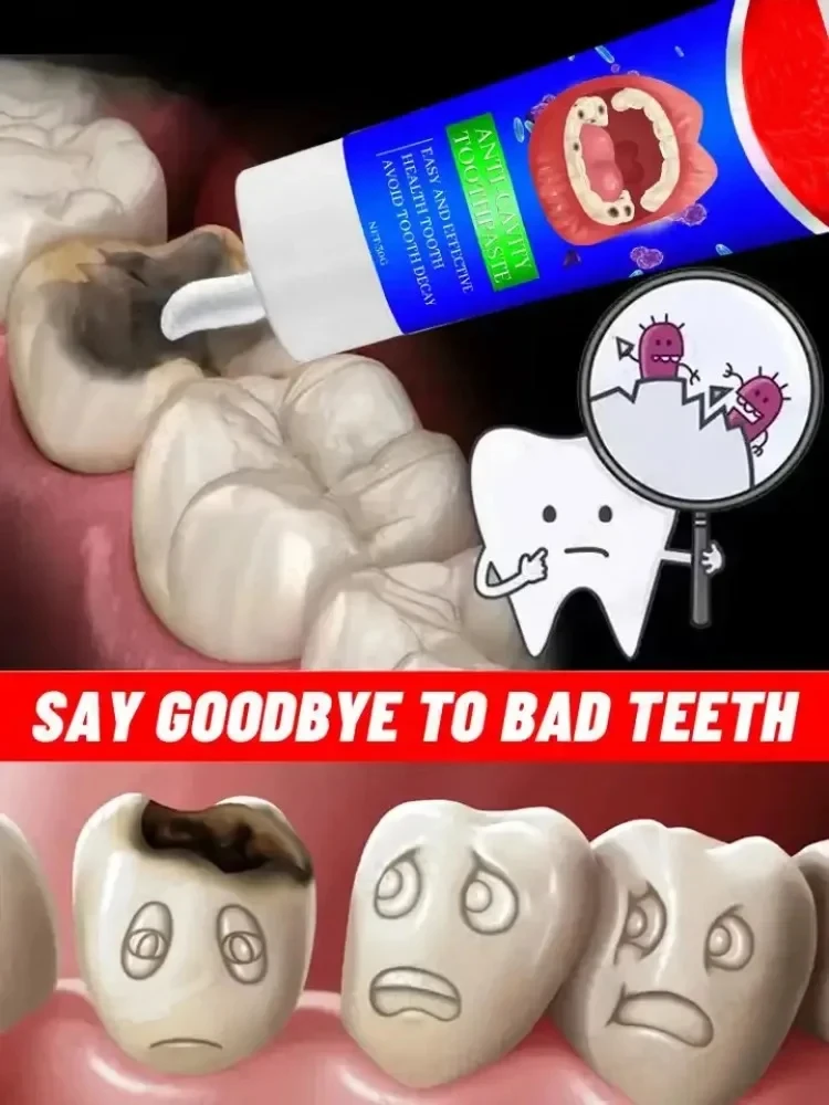 Quickly Repair Of Cavities Caries Toothpaste Teeth Clean Whiten Remove Yellow Plaque Stains Relieve Gums Decay Toothache